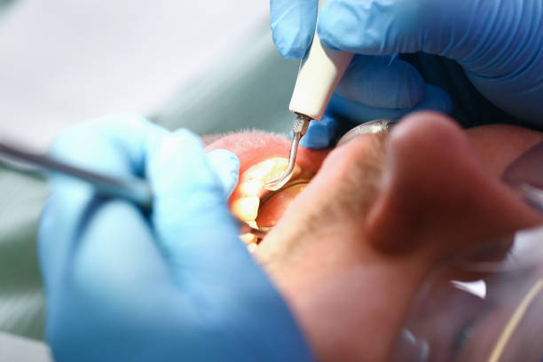 Best Emergency Gum Treatment in Black River Falls, WI